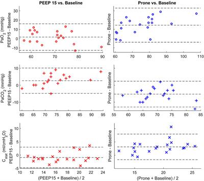 Lung Recruitment, Individualized PEEP, and Prone Position Ventilation for COVID-19-Associated Severe ARDS: A Single Center Observational Study